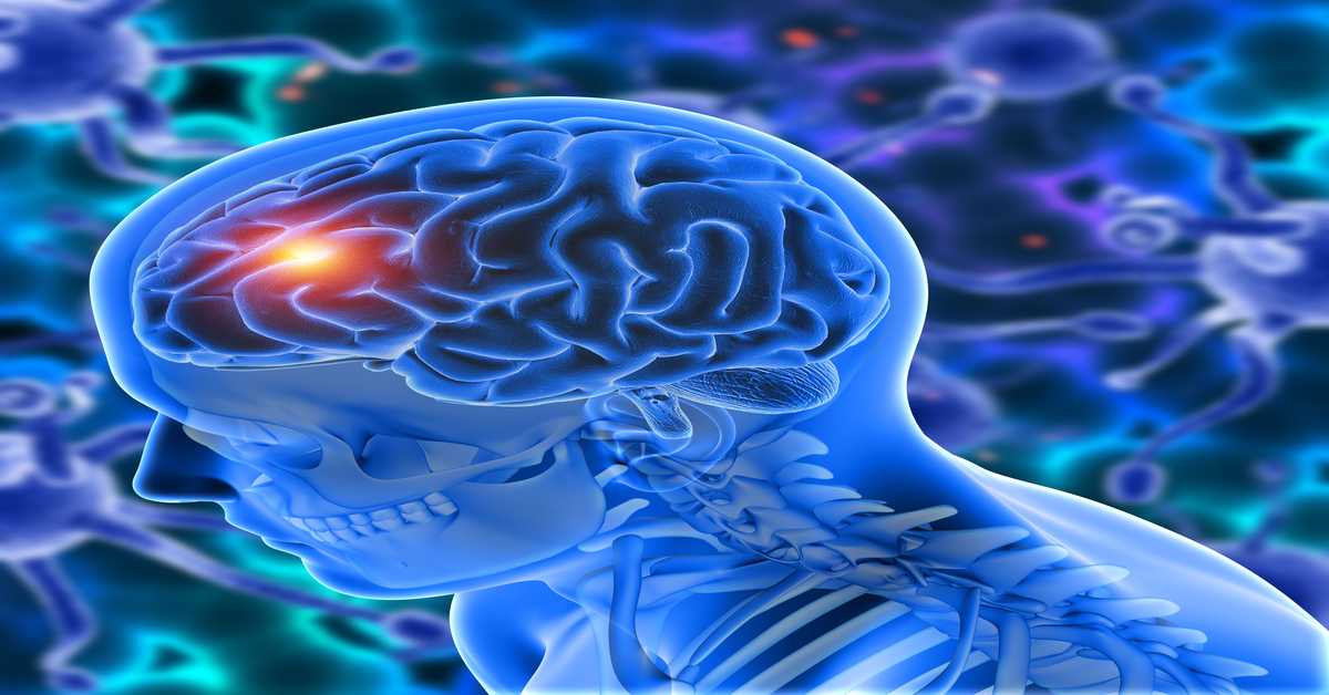 Brain Tumor Identification and Treatment