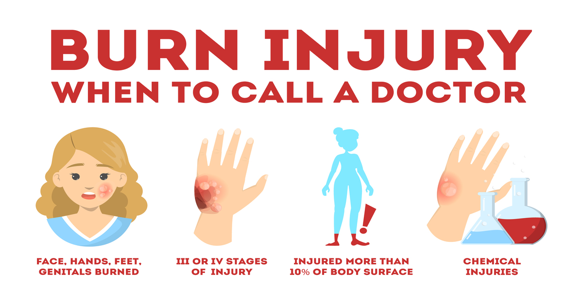 How bad should a burn for it to be hospitalized?