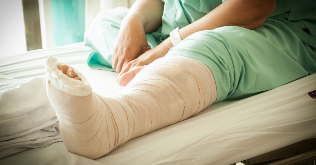 Broken leg treatment in Coimbatore: Know how therapy benefits