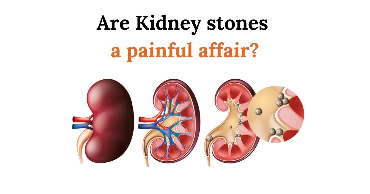 Are Kidney stones a painful affair? Know how to treat them
