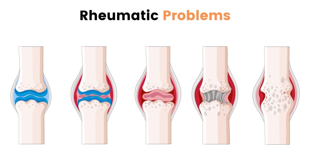 What are the types of rheumatic problems?