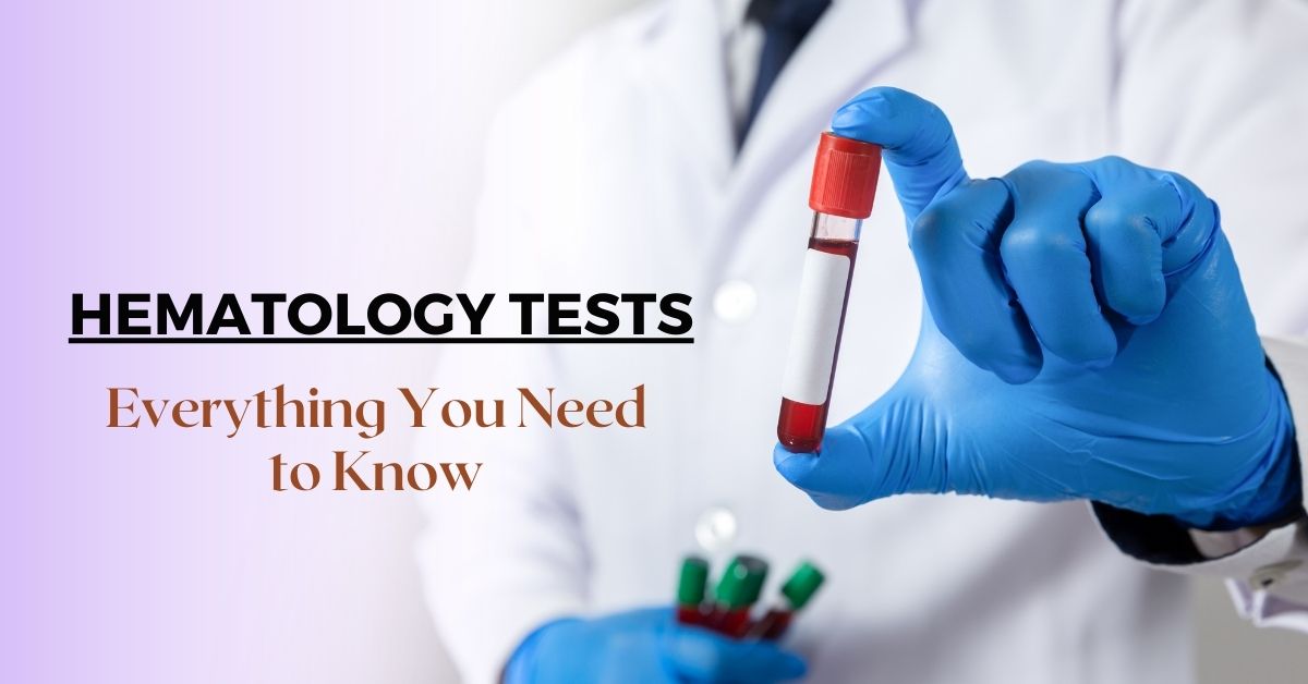 Hematology Tests: Diagnostic procedures for blood diseases