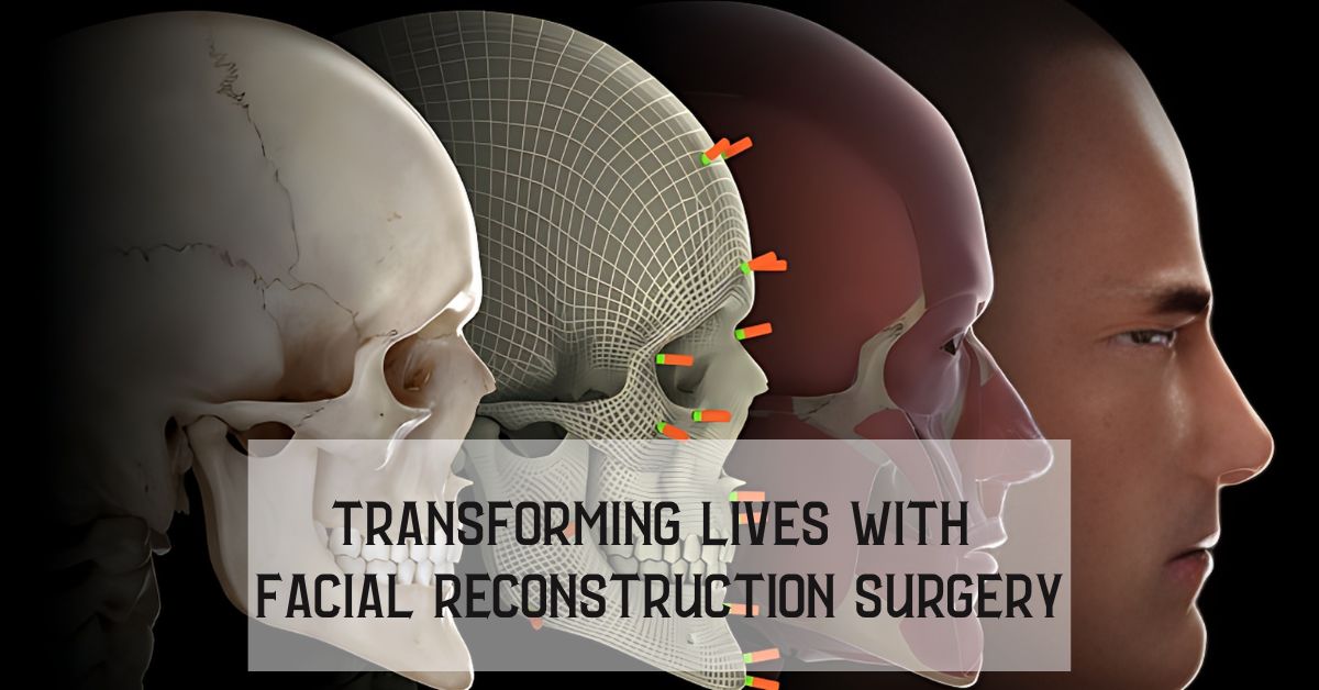 A New Beginning: How Facial Reconstruction Surgery Can Help You Start Over