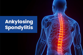 ankylosing spondylitis specialists in coimbatore