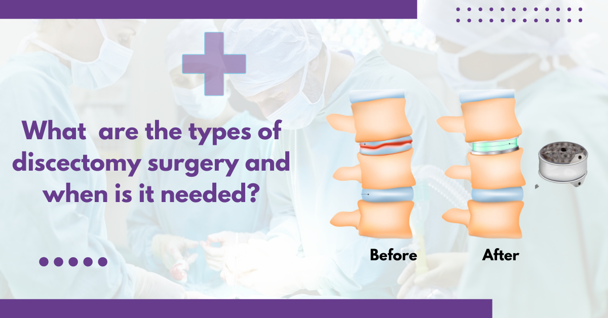 What Are The Types of Discectomy Surgery And When Is It Needed?