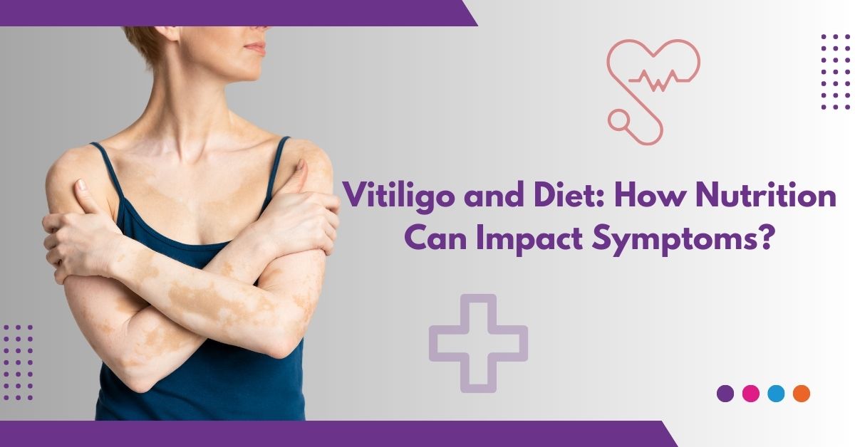 Vitiligo and Diet: How Nutrition Can Impact Symptoms?