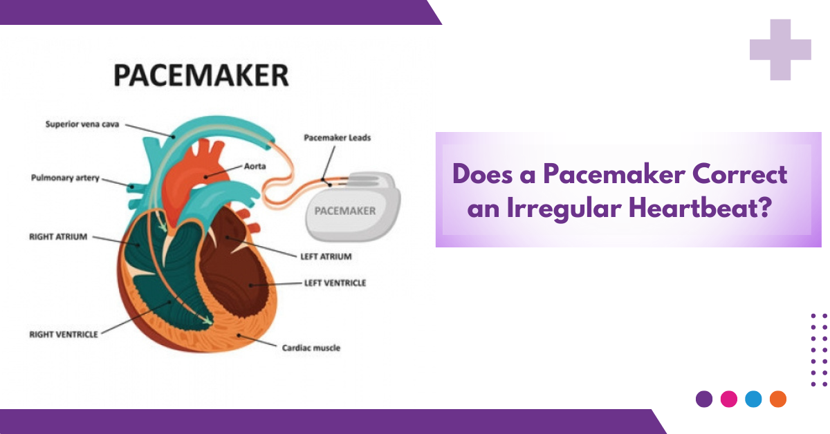 Does a Pacemaker Correct an Irregular Heartbeat?