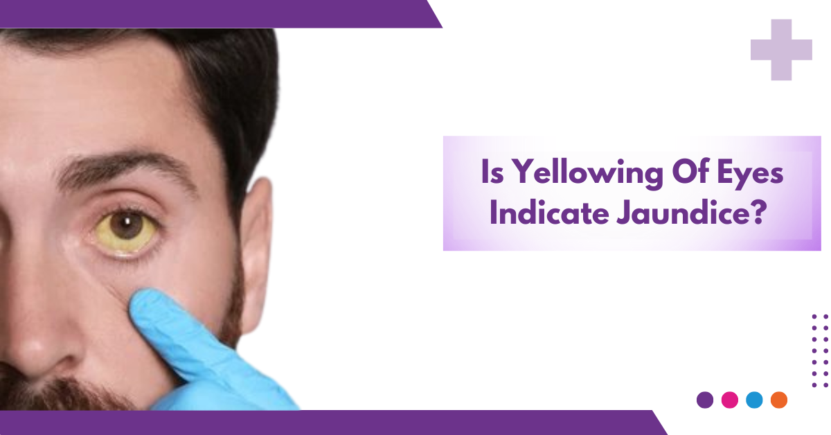 Jaundice -Sriramakrishnahospital